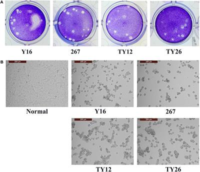 Epidemiology and Genetic Variabilities of Human Adenovirus Type 55 Reveal Relative Genome Stability Across Time and Geographic Space in China